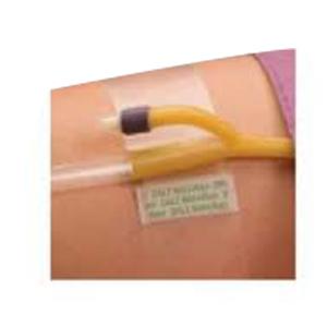 Dale Hold-N-Place Adhesive Patch Foley Catheter Holder